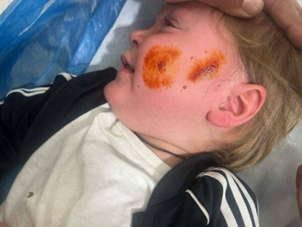 aitoliko paidi adespoto travmatismos 768x576