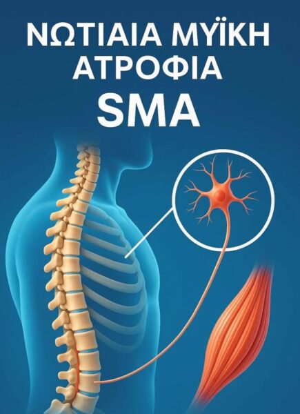 sma Νωτιαία Μυϊκή Ατροφία